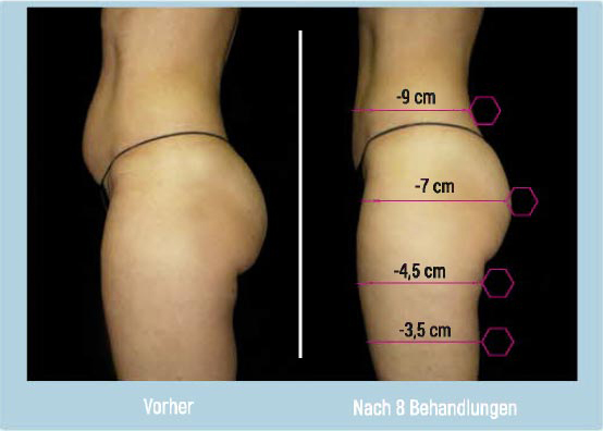 Slimformer